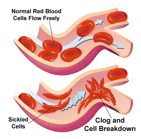 Hemoglobin